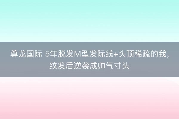 尊龙国际 5年脱发M型发际线+头顶稀疏的我，纹发后逆袭成帅气寸头
